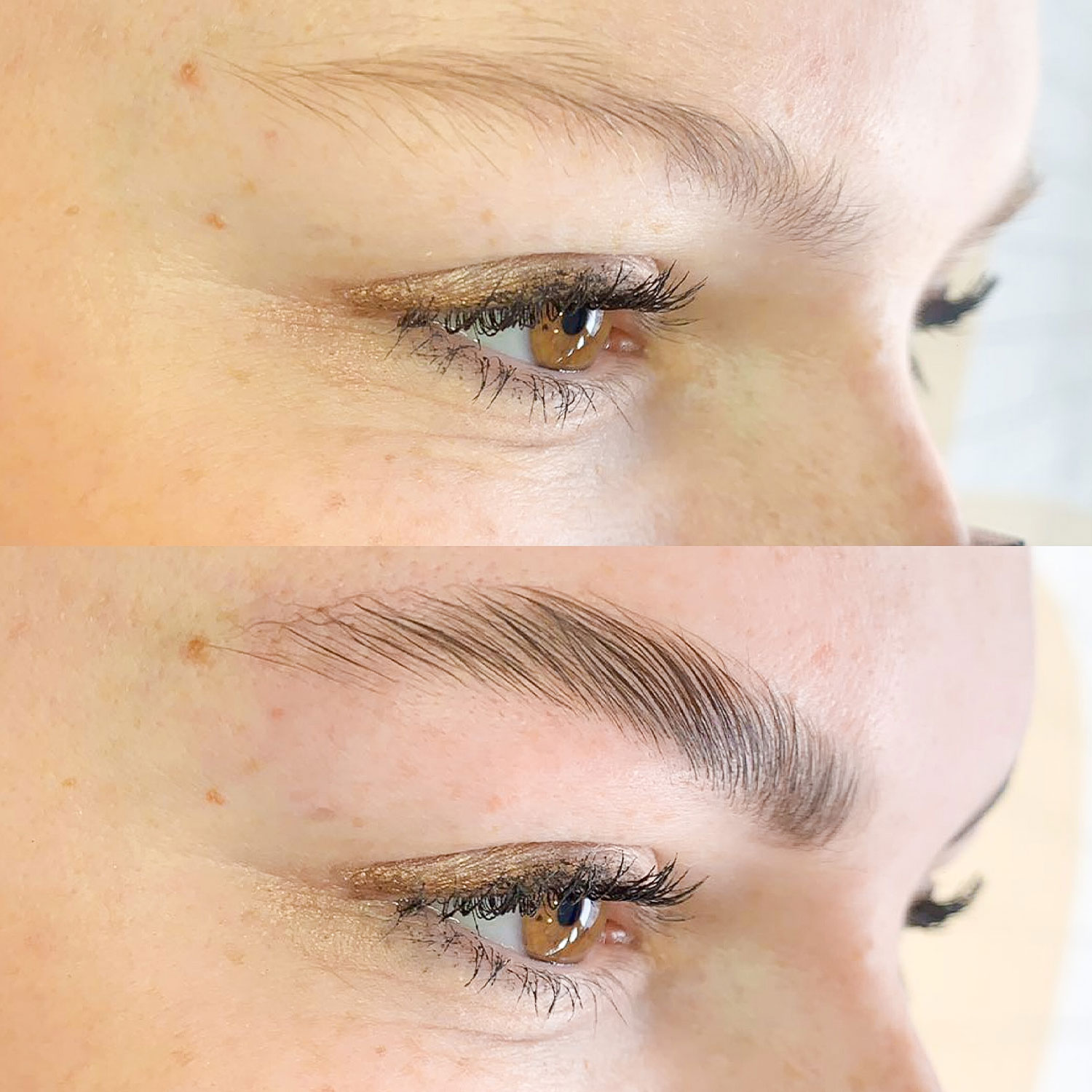 brow_Lifting_2_produktbild_mbbynas