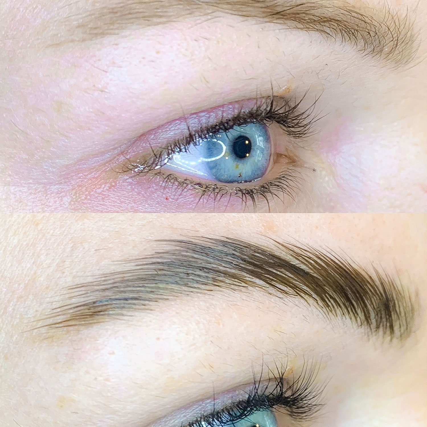 brow_lifting_1_produktbild_mbbynas