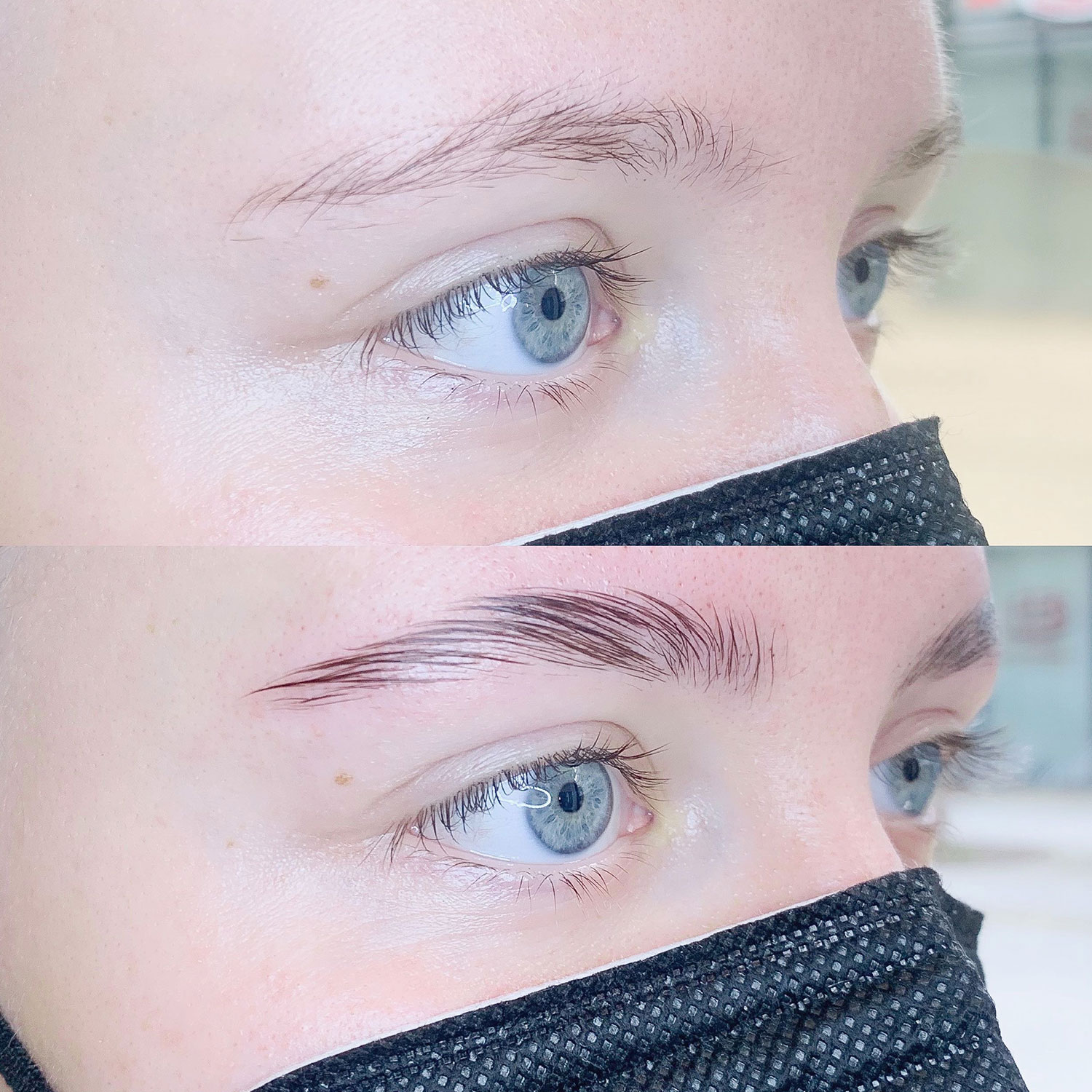 brow_lifting_3_produktbild_mbbynas