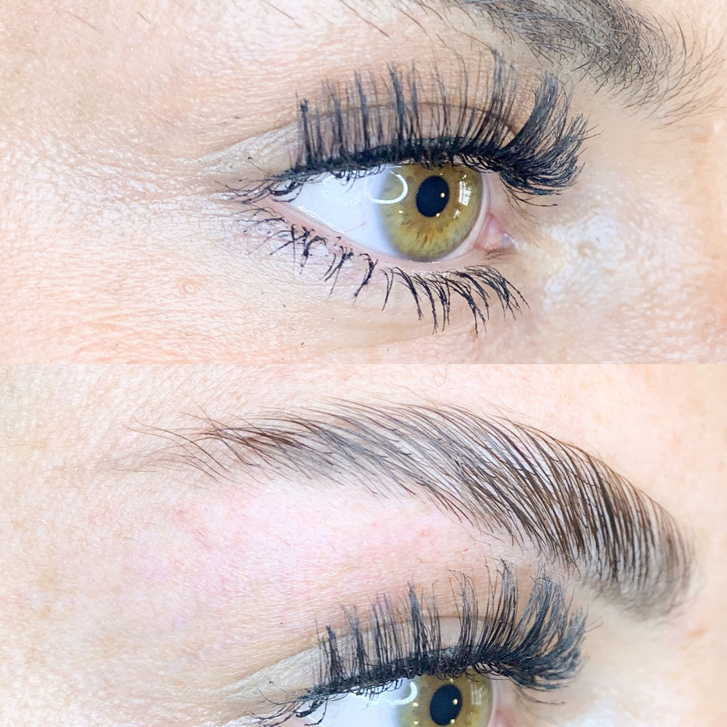 brow_lifting_4_produktbild_mbbynas